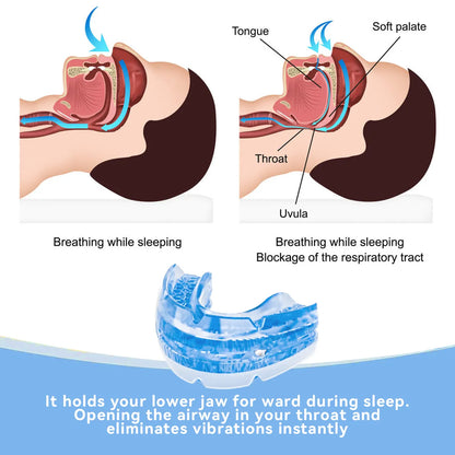 Adjustable Anti Snoring Mouthpiece